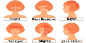 Miğren Ağrısı